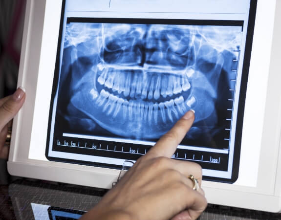 Dentist examining all digital x-rays
