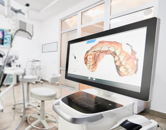 Smile images on digital impression system