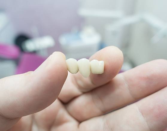 A dental bridge held between a thumb and index finger