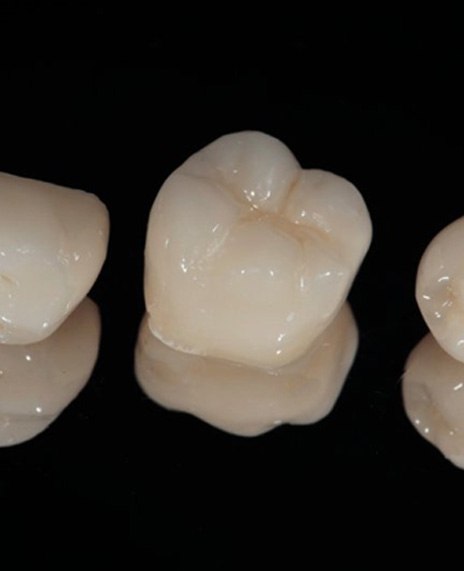 Dental crowns