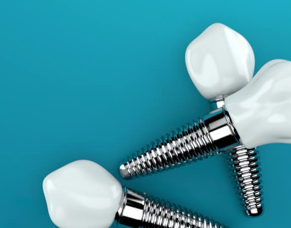 Three animated dental implant supported teeth