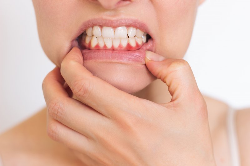 A closeup of a mouth with inflamed gums